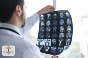 Why Choose Trujillo Gonzalez, P.C. After a Brain Injury in Dallas, TX?